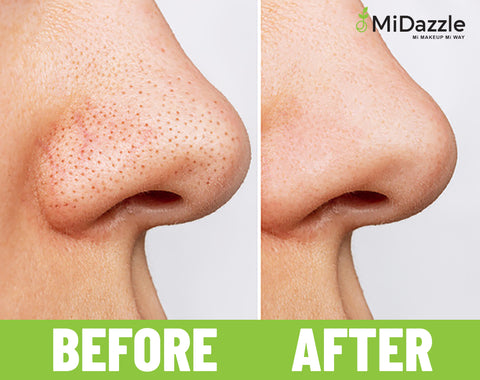 BLACK HEAD REMOVER MIBR3301 ₹ 89/-