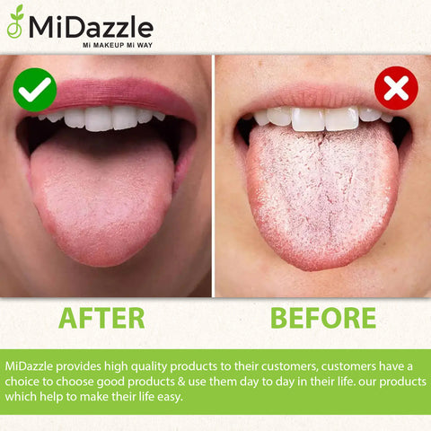 METAL STAINLESS STEEL HANDLE MIOT7502 ₹ 165/-