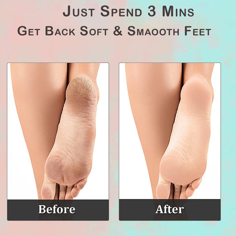 2 In 1 Ractangle MIFF5203