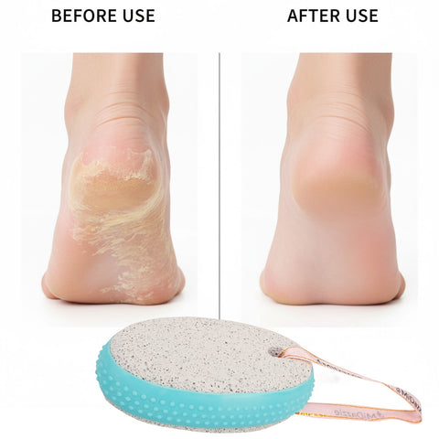 Oval With Grip MIPS5106